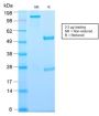 Thymidine Phosphorylase / PD-ECGF (Angiogenesis Marker) (TYMP/2890R), 1mg/mL