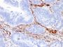 Nestin (Cancer Stem Cell Marker)(NES/2911), 1mg/mL