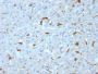 C1QA / Complement C1q A-Chain(C1QA/2953), 1mg/mL
