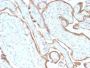 EGFR (Epidermal Growth Factor Receptor) (GFR/2968R), 1mg/mL