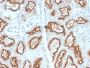 Renal Cell Carcinoma (Carbonic Anhydrase IX) (CA9/2993R), 1mg/mL