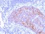 HER-2 / c-erbB-2 / neu / CD340(ERBB2/3078), 1mg/mL