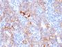 HER-2 / c-erbB-2 / neu / CD340(ERBB2/3080), 1mg/mL