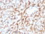 Cathepsin D (Tumor Marker)(CTSD/3082), 1mg/mL