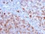Cathepsin D (Tumor Marker)(CTSD/3083), 1mg/mL