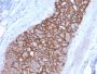 HER-2 / c-erbB-2 / neu / CD340(ERBB2/3092), 1mg/mL