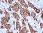 HER-2 / c-erbB-2 / neu / CD340(ERBB2/3093), 1mg/mL