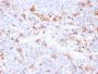 S100A9 + Calprotectin (S100A8/A9 Complex)(MAC3157R), 1mg/mL