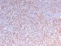 ALK (Anaplastic Lymphoma Kinase) / CD246(ALK/3218R), 1mg/mL