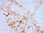 Endoglin / CD105 (Angiogenesis Marker)(ENG/3269), 1mg/mL