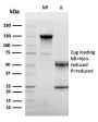 Endoglin / CD105 (Angiogenesis Marker)(ENG/3269), 1mg/mL