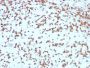 Cathepsin D (Tumor Marker)(CTSD/3275), 1mg/mL