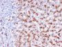 Cathepsin D (Tumor Marker)(CTSD/3276), 1mg/mL