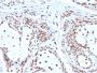 Nucleophosmin (Acute Myeloid Leukemia Marker)(NPM1/3286), 1mg/mL