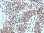 Nucleophosmin (Acute Myeloid Leukemia Marker)(NPM1/3287), 1mg/mL
