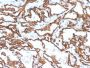 CD31 / PECAM-1 (Endothelial Cell Marker)(PECAM1/3529), 1mg/mL
