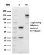 Cyclin D1 (G1-Cyclin & Mantle Cell Lymphoma Marker)(CCND1/3548), 1mg/mL
