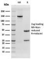 EGFR (Epidermal Growth Factor Receptor)(rGFR/1667), 1mg/mL