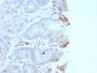von Willebrand Factor / Factor VIII Related-Ag (Endothelial Marker)(rVWF/2480), 1mg/mL