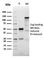 Prolactin Receptor (hPRL Receptor)(PRLR/3785R), 1mg/mL