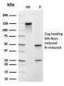 Frataxin (Mitochondrial Marker)(rFXN/2124), 1mg/mL