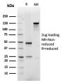 GLUT-1 (Tumor Progression and Mesothelioma Marker)(rGLUT1/2476), 1mg/mL