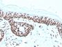 Nucleophosmin (Acute Myeloid Leukemia Marker)(rNPM1/1901), 1mg/mL