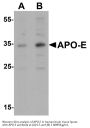 Anti-APO-E Antibody