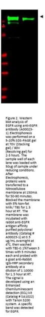 Anti-EGFR Antibody