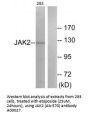 Anti-JAK2 (Ab-570) Antibody