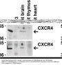 Anti-CXCR4 Antibody