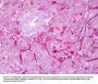 Anti-NOTCH 1 Antibody