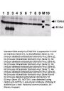 Anti-NOTCH 1 Antibody