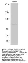 Anti-Phospho-Rb (S807) RB1 Antibody