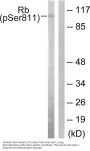 Anti-Phospho-Rb (S811) RB1 Antibody