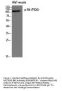 Anti-Phospho-Rb (T826) RB1 Antibody