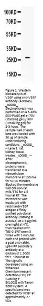 Anti-VEGF/Vegfa Antibody Picoband®