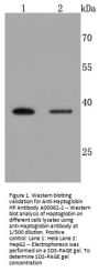 Anti-Haptoglobin HP Antibody