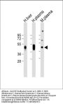Anti-HP Antibody (Center)