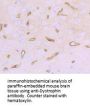 Anti-Dystrophin DMD Antibody