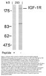 Anti-IGF-1R (Ab-1161) Antibody