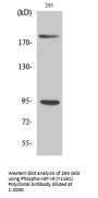 Anti-Phospho-IGF-IR (Y1161) IGF1R Antibody
