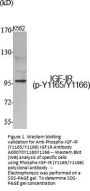 Anti-Phospho-IGF-IR (Y1165/Y1166) IGF1R Antibody