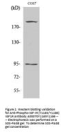 Anti-Phospho-IGF-IR (Y1165/Y1166) IGF1R Antibody