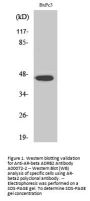 Anti-AR-beta ADRB2 Antibody