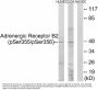Anti-Phospho-AR-beta (S355/S356) ADRB2 Antibody