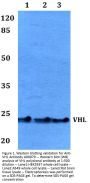 Anti-VHL Antibody