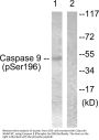 Anti-Phospho-Caspase-9 (S196) CASP9 Antibody