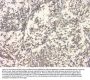 Anti-APP/C99 Antibody Picoband®