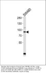 Anti-PCSK9 Antibody (N-term)